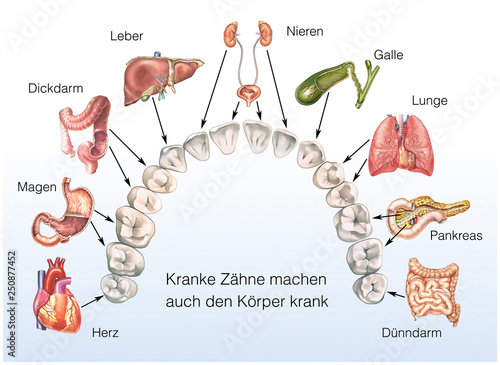 Wie Zähne die Organe beeinflussen können. Kranke Zähne, kranker Körper