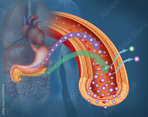 diabetes mellitus tipo 1  photo