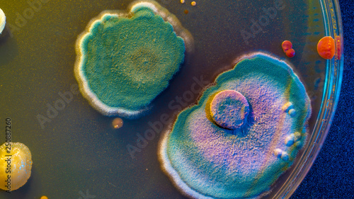 Obraz na płótnie close up petri dish with microbe colony