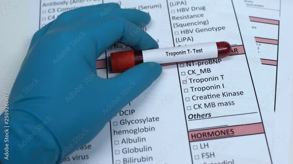 Troponin T, doctor checking name in lab blank, showing blood sample in