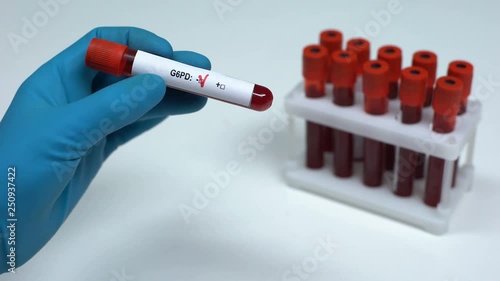 Negative G6PD test, doctor showing blood sample, lab research, health check-up photo