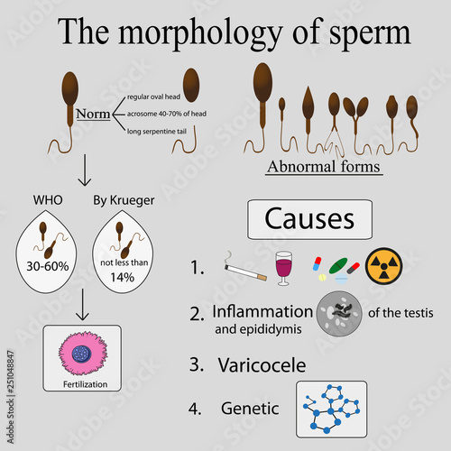 Infographics sperm morphology.