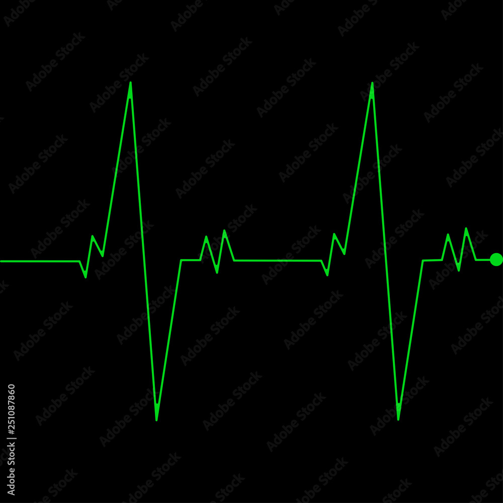 Cardio monitoring system isolated on black background. Heart pulse, signal. Heartbeat, electrocardiogram line. Cardiology medical chart. Vector flat illustration.