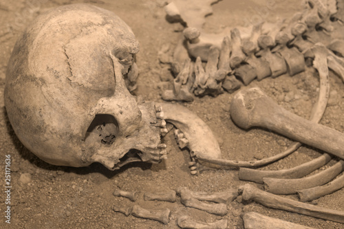 Tableau sur toile the skeleton of a man