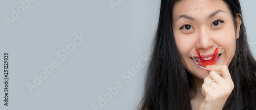 Portrait of beautiful Asian patient woman holding orthodontic retainers in dental clinic, Smiling Girl Holding blue Retainer, Braces for Teeth. Orthodontics Dental Theme, Methods of Teeth Correction