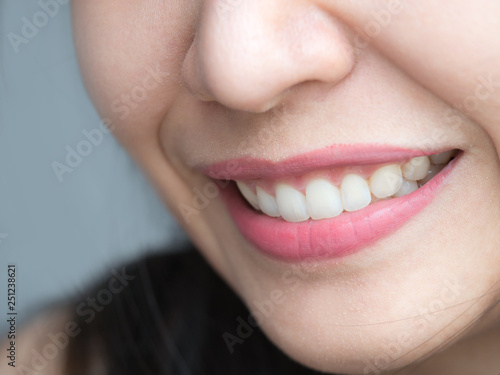 Closeup shot of Asian Chinese Thai woman female makeup face. Woman with red lips lipstick and healthy dental white great perfect teeth. Smiling  Dental dentist clinic concept. mouth open. wisdom tooth