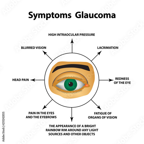 Symptoms of glaucoma. World glaucoma day. The anatomical structure of the eye. Infographics. Vector illustration on isolated background.