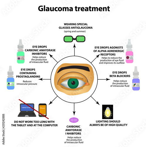 Glaucoma treatment. Eye drops. World glaucoma day. The anatomical structure of the eye. Infographics. Vector illustration on isolated background.