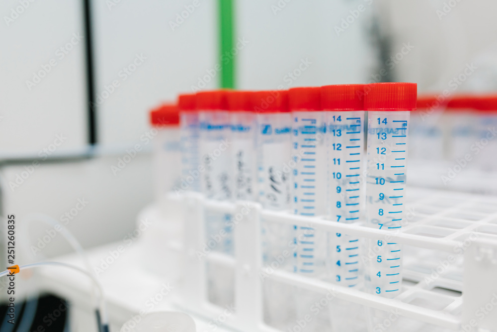 Test, experimenting or analyzing plastic medical blood tubes in modern lab or hospital with equipments, tools and machines. Test, experimenting or analyzing plastic medical blood tubes in modern lab or hospital with equipments, tools and machines.