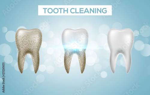 Tooth clean 3d health. Dental realistic dirty whitening. Dentist teeth hygiene isolated medicine template