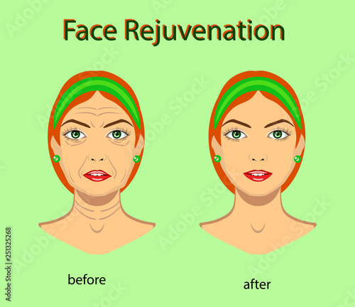 Face rejuvenation, vector illustration with before after effect