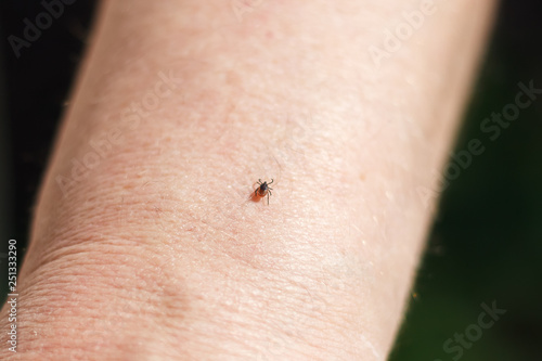 a dangerous encephalitis tick crawling on a human arm