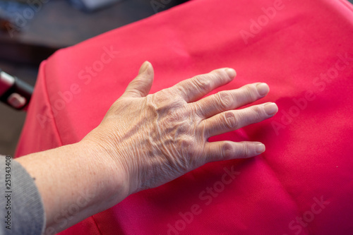 These are hands of a old woman with finger pain © Vince Scherer 