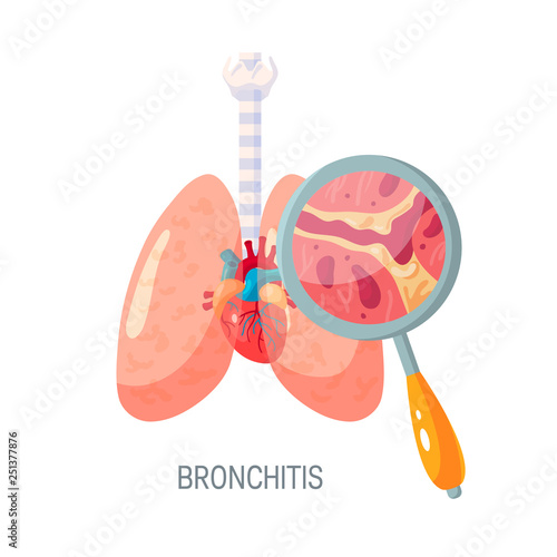 Bronchitis disease vector icon in flat style