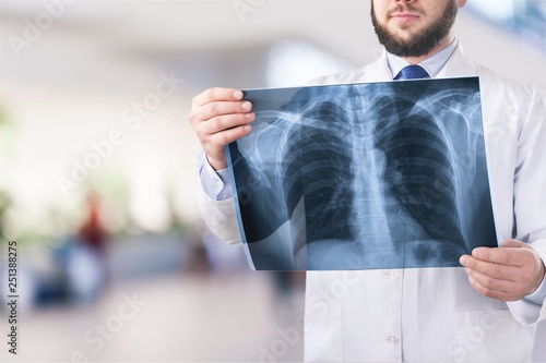 Young man doctor holding x-ray