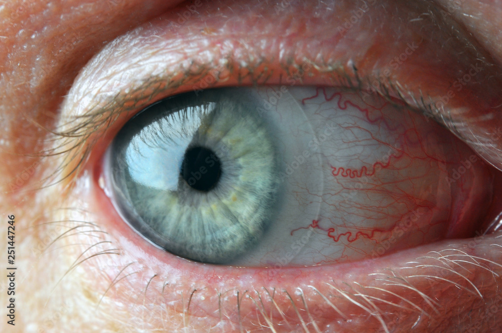 Fototapeta premium Eye with contact lens.