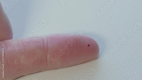 Female finger at home blood sugar test not enought blood in macro photo