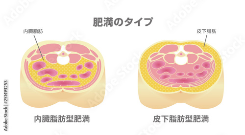 腹部断面図イラスト「肥満のタイプ」/ 内臓脂肪、皮下脂肪