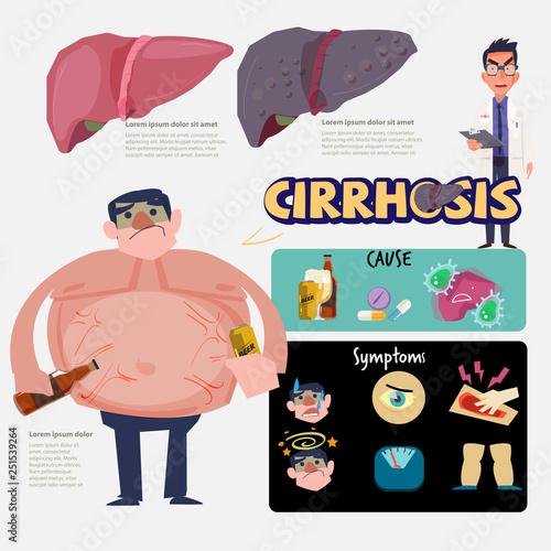 cirrhosis symptoms and treatment infographic