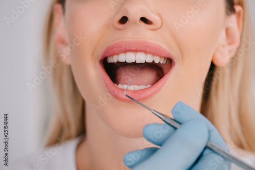 cropped view of dentist examining teeth of young woman with dental probe