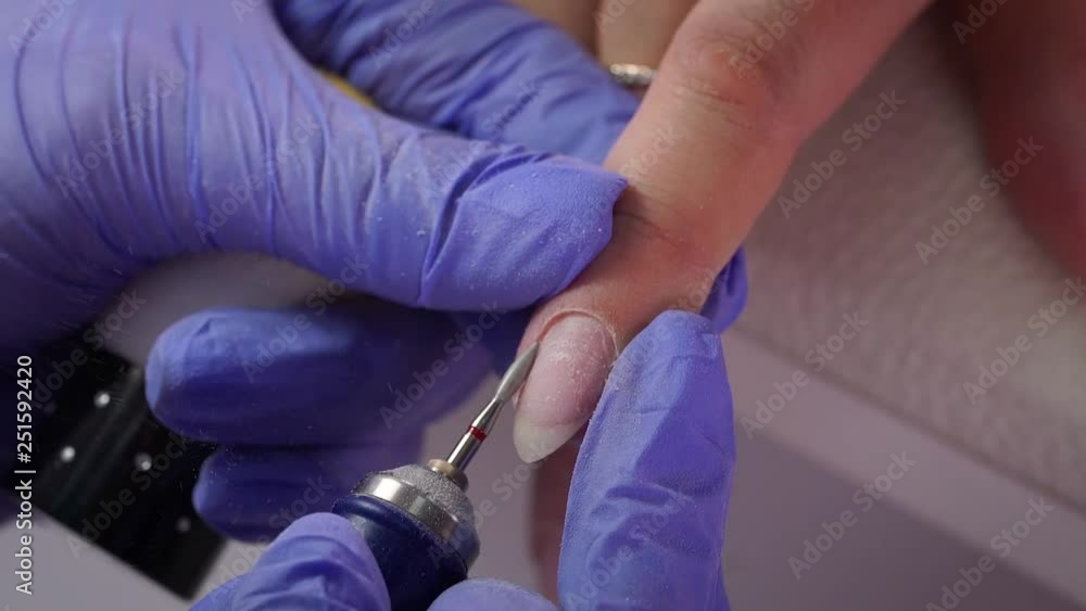 Cuticle removal macro Cuticle removal macro