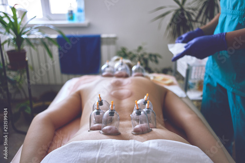 Φωτογραφία Healing bloodletting, hijama or phlebotomy