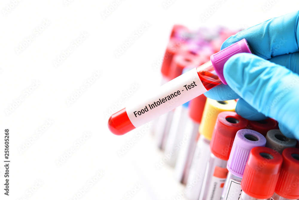 Obraz premium Test tube with blood sample for food intolerance test