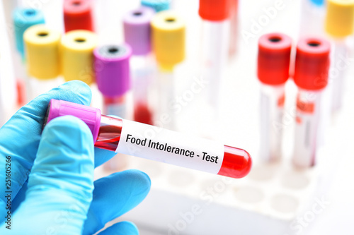 Photography Test tube with blood sample for food intolerance test