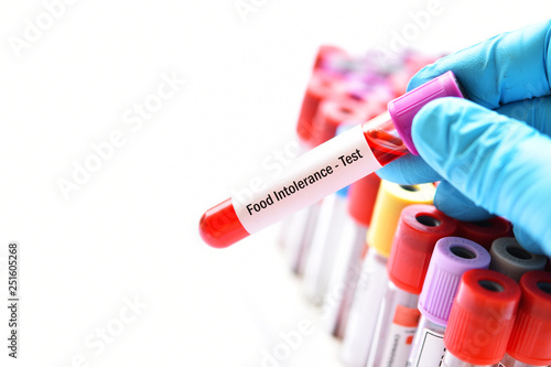 Test tube with blood sample for food intolerance test photo