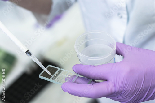 Obraz na płótnie Application of urine and sperm samples in Goryaev's chamber
