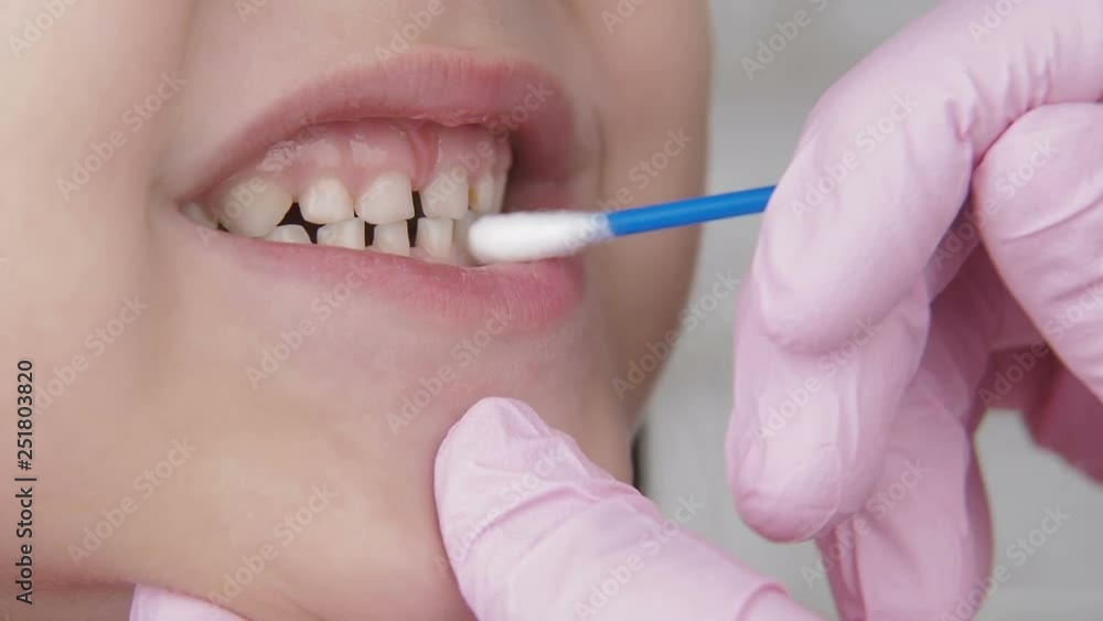 Dentist cleans the child's teeth. Brush the baby's milk teeth. Dentist cleans the child's teeth. Brush the baby's milk teeth.