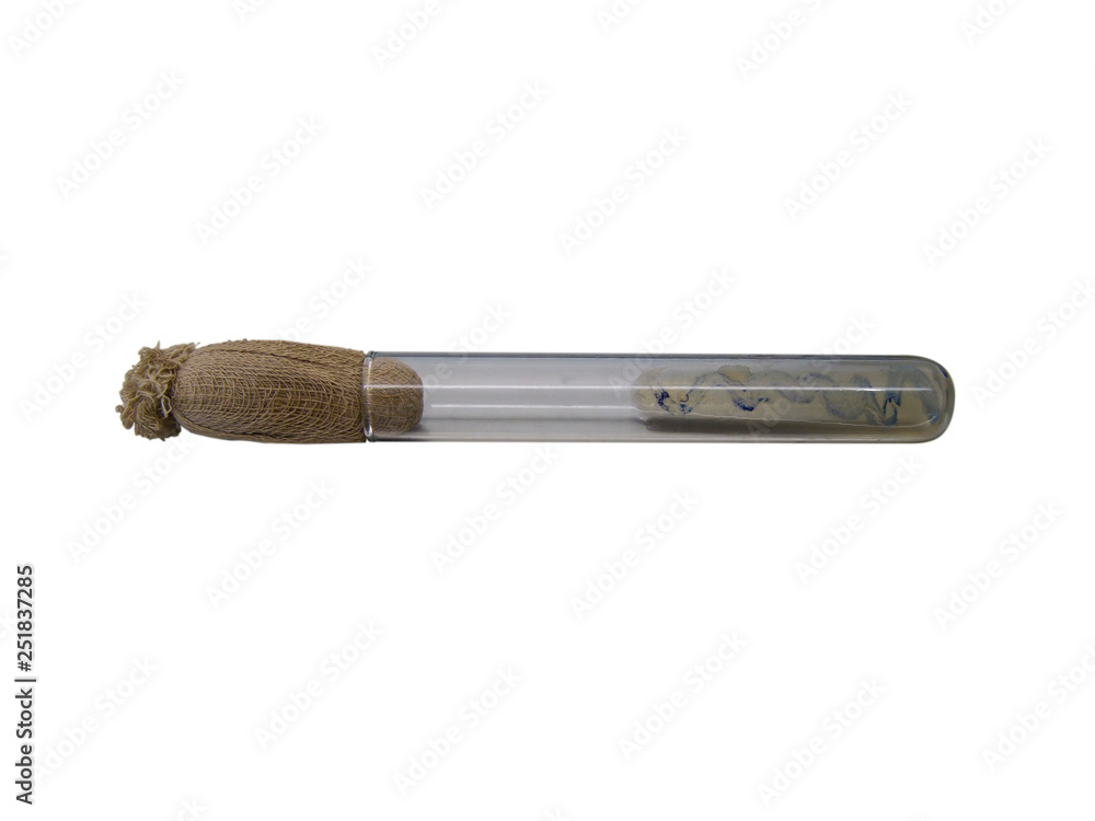 isolated test tube with grown colonies of gonorrhea (Neisseria gonorrhoeae) after a positive reaction to cytochrome oxidase isolated test tube with grown colonies of gonorrhea (Neisseria gonorrhoeae) after a positive reaction to cytochrome oxidase