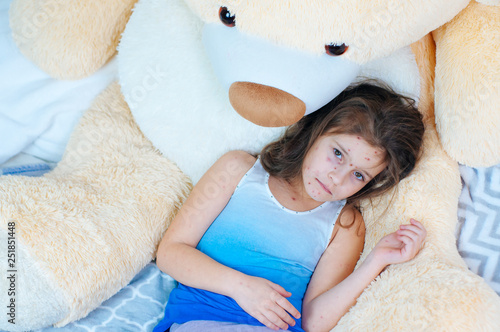 Obraz na plátně Closeup of cute sad little girl near the teddy bear