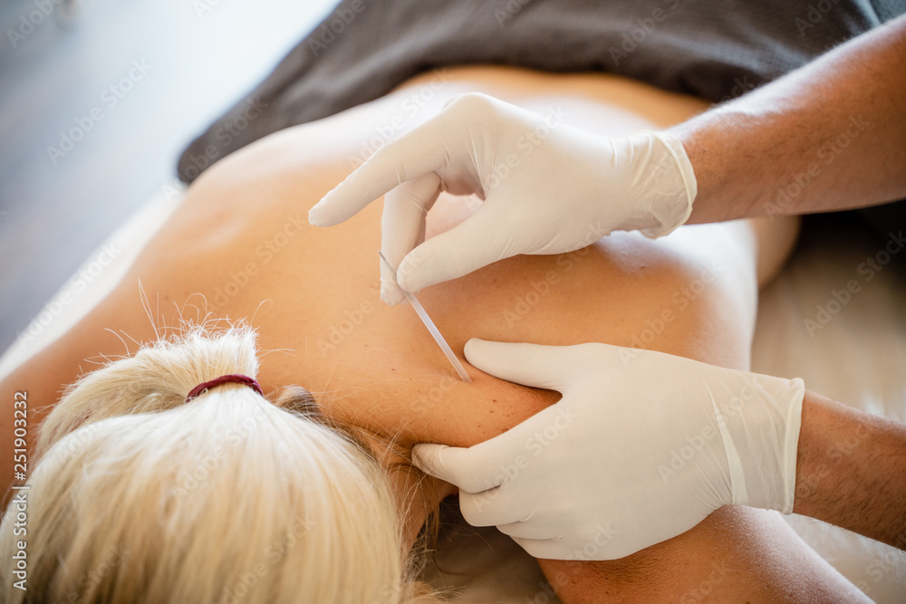 Naklejka premium Fisioterapia manos punción seca clinica