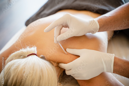 Fisioterapia manos punción seca clinica