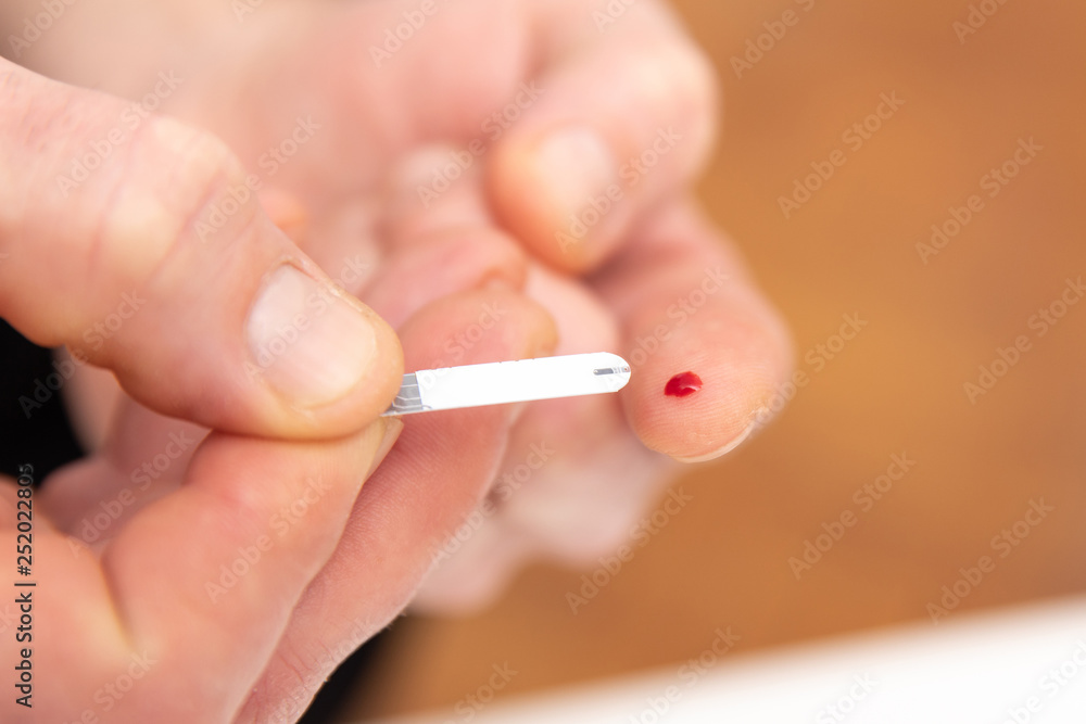 Diabetic is doing a glucose level finger blood test Diabetic is doing a glucose level finger blood test
