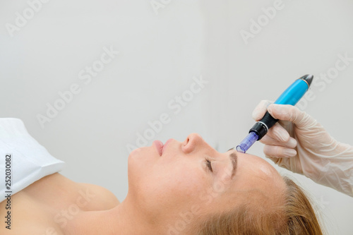 Cosmetologist making mesotherapy injection. Microneedle mesotherapy. Treatment woman at beautician. Hardware cosmetology. Mesotherapy, dermapen, treatment of face zone, face rejuvenation.  Close up photo