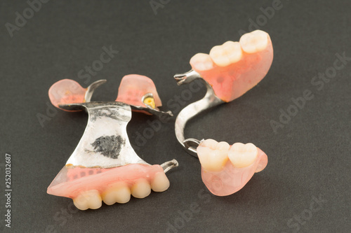 large image of a modern arc denture with attachmens photo