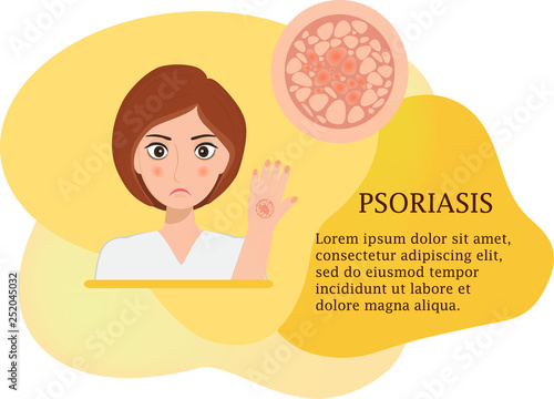 Concept of psoriasis. Sad cute girl is on the vector modern poster., fluid background. Disease of the skin, dermatological problems.