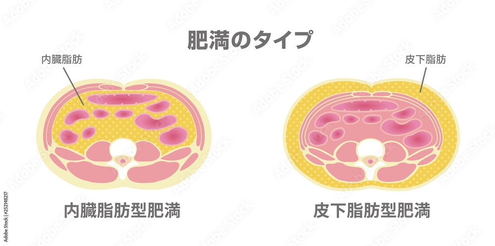腹部断面図イラスト 肥満のタイプ 内臓脂肪 皮下脂肪 Stock ベクター Adobe Stock 腹部断面図イラスト 肥満のタイプ 内臓脂肪 皮下脂肪 Stock ベクター Adobe Stock