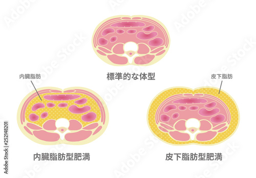 腹部断面図イラスト「肥満のタイプ」/ 標準体型、内臓脂肪、皮下脂肪