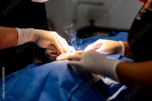 Cauterization