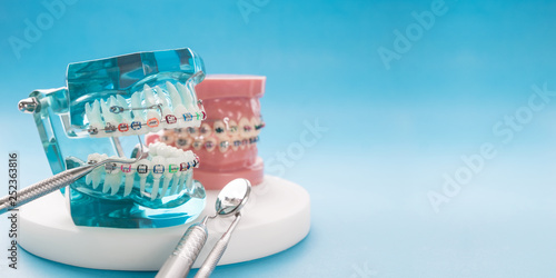 orthodontic model and dentist tool - demonstration teeth model of varities of orthodontic bracket or brace photo