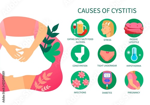 Vector medical poster reasons of cystitis. Diseases of the genitourinary system. Illustration of a girl in a skirt.