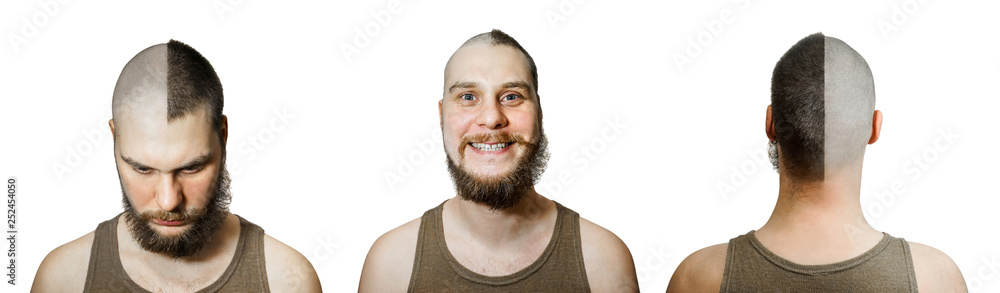 half trimmed guy: on the one hand bald, on other with hair on isolated white background. Front view, back. Concept for hairdresser, and medicine: the problem of hair loss, alopecia, transplantation half trimmed guy: on the one hand bald, on other with hair on isolated white background. Front view, back. Concept for hairdresser, and medicine: the problem of hair loss, alopecia, transplantation