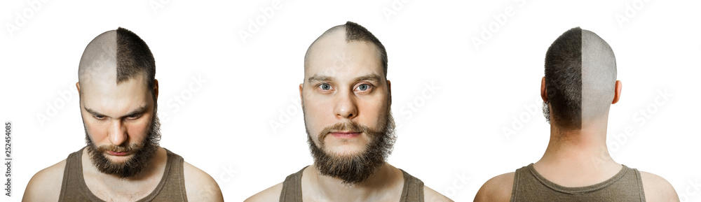 Fototapeta premium half trimmed guy: on the one hand bald, on the other with hair on isolated white background. Front view, back. Concept for hairdresser, and medicine: problem of hair loss, alopecia, transplantation
