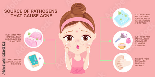 Source of pathogens that cause acne