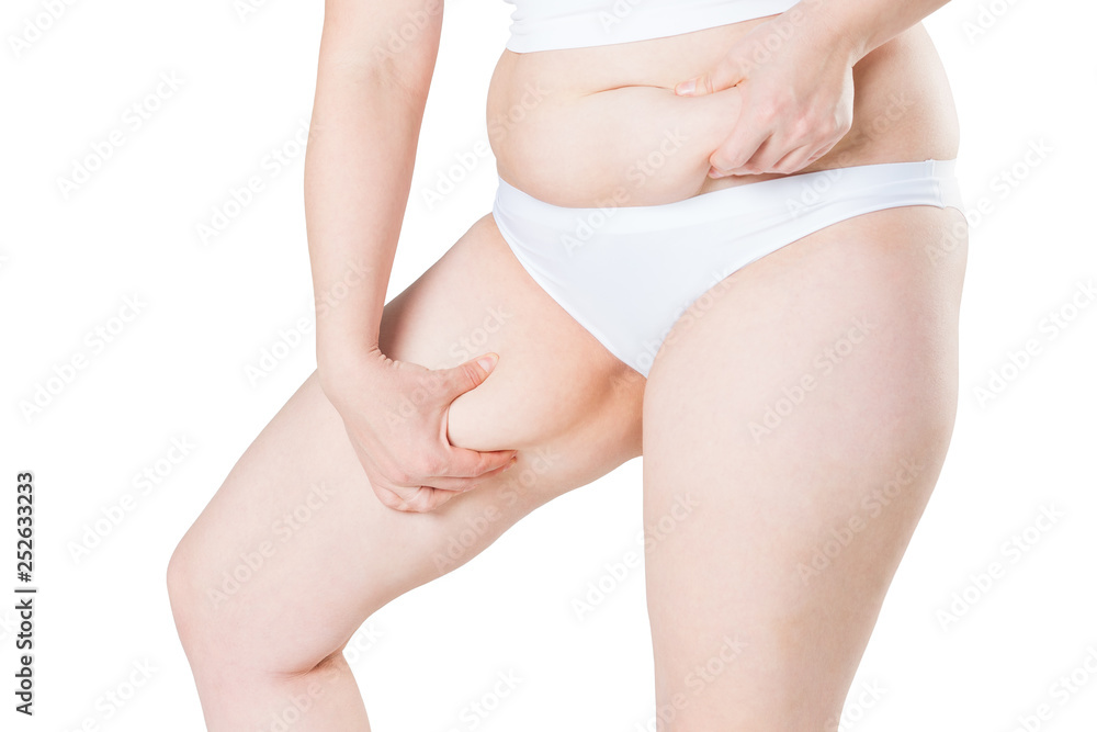 Overweight woman with fat thighs, obesity female legs isolated on white background