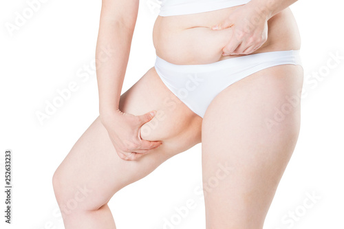 Overweight woman with fat thighs, obesity female legs isolated on white background © staras