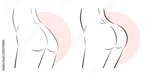 beauty woman with butt implant